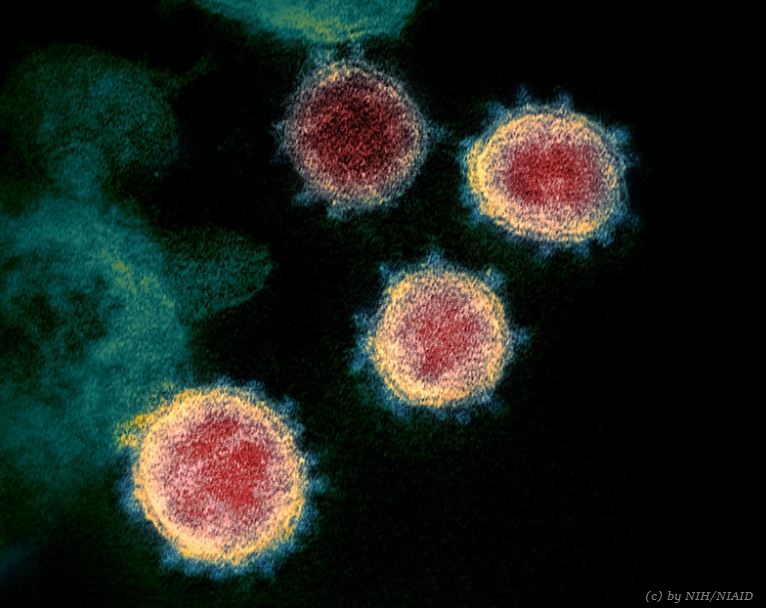 Coronavirus Toter